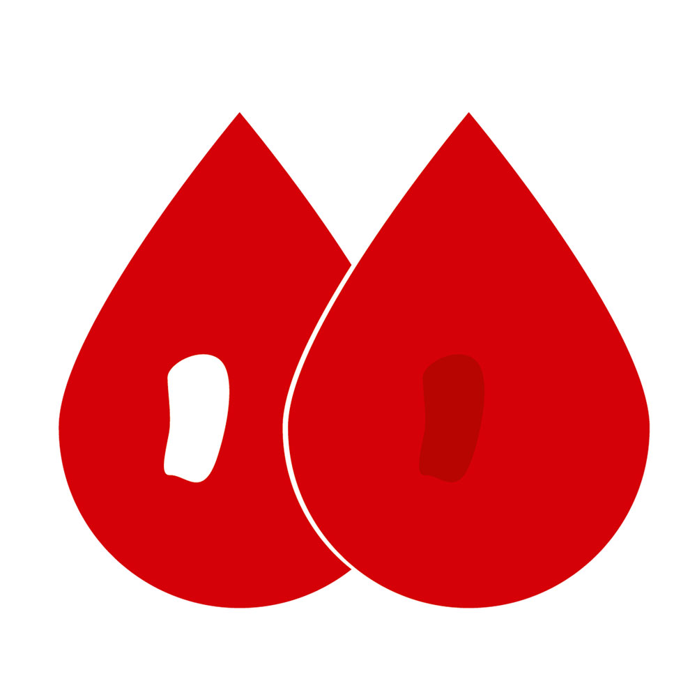 Paper & Boarding printing troubleshooting Siegwerk